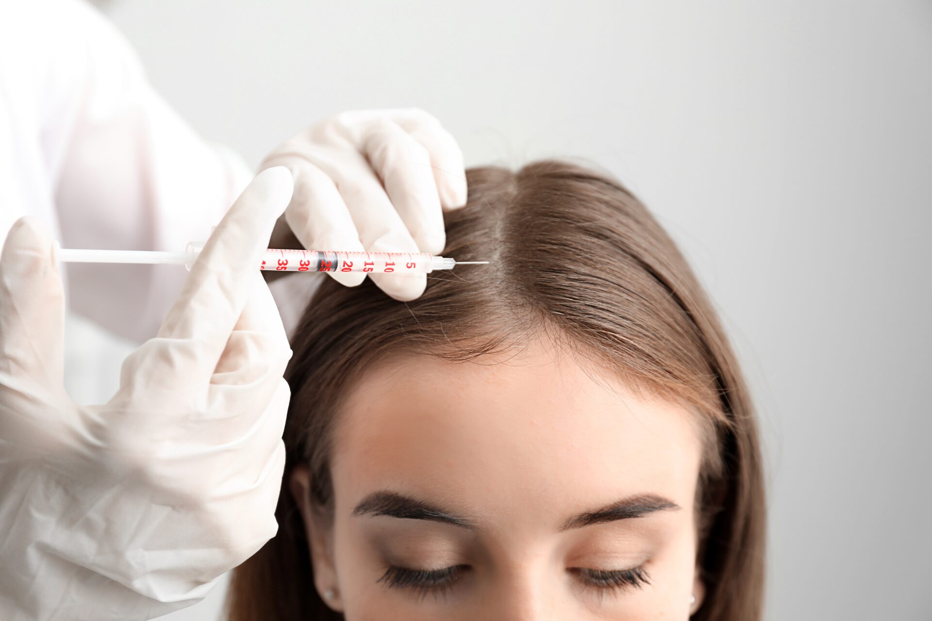 Haartransplantation In Frankfurt Am Main Haartransplantation Deutschland: Beste Klinik in Frankfurt
