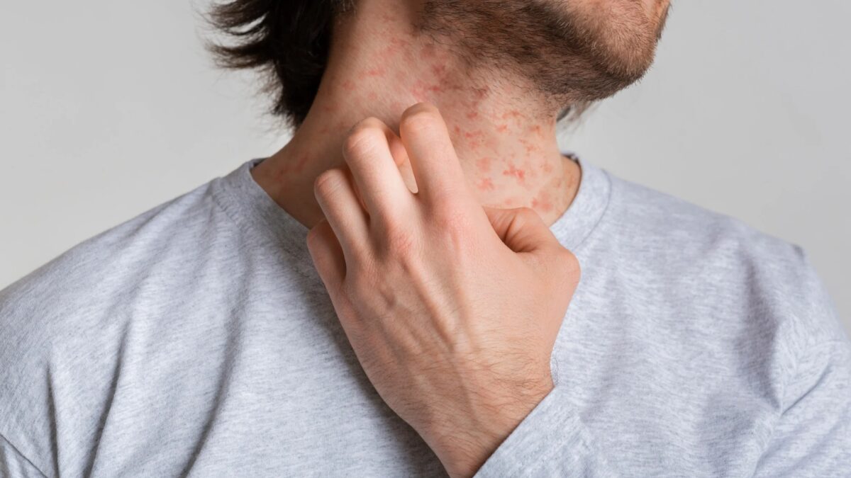 Winzige rote Punkte auf der Haut  Ursachen, Symptome und was sie bedeuten