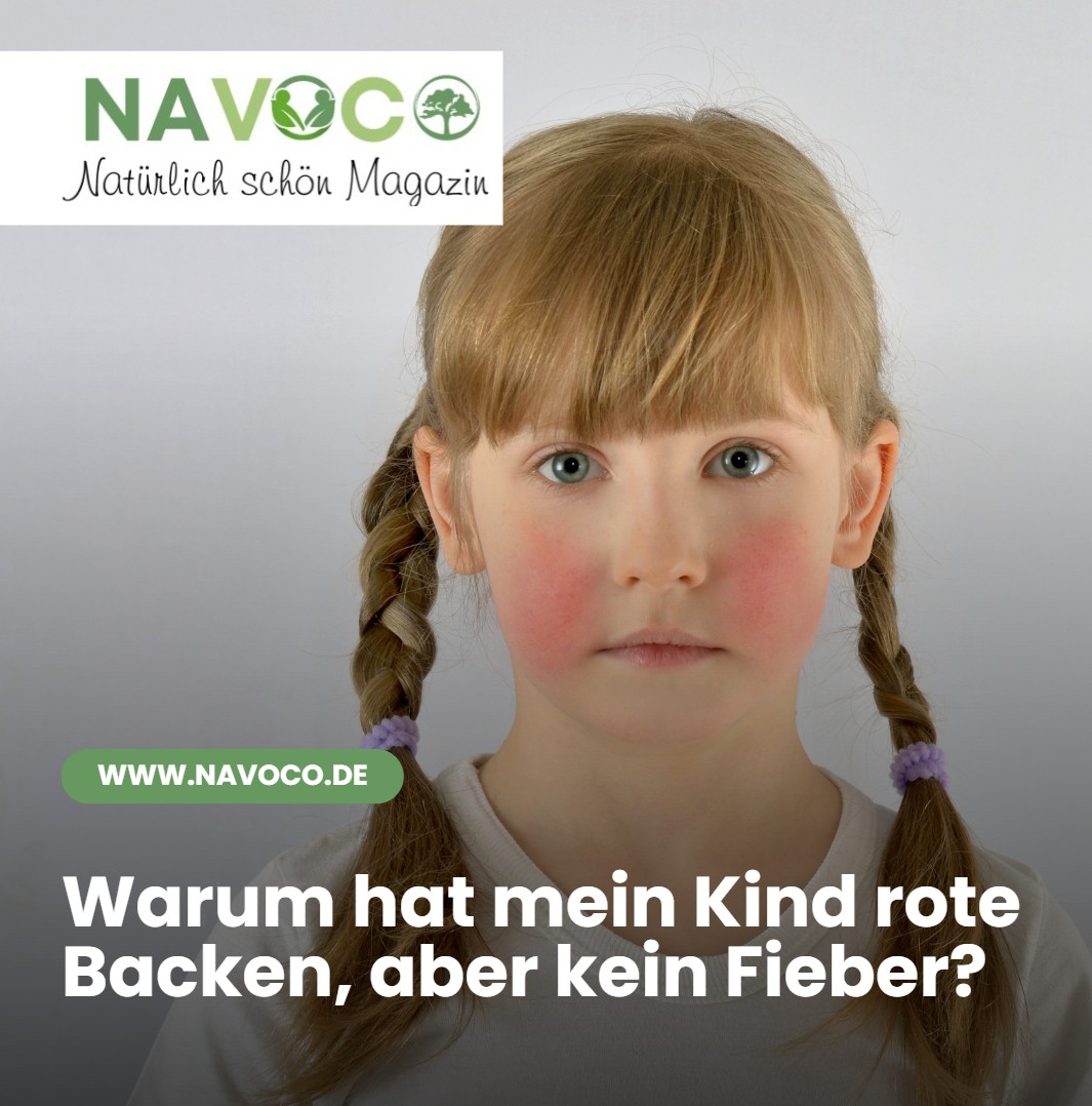 Warum hat mein Kind rote Backen, aber kein Fieber Warum hat mein Kind rote Backen, aber kein Fieber