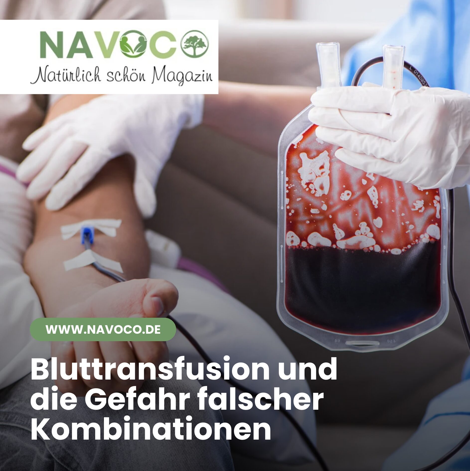 Was ist die seltenste Blutgruppe? Bluttransfusion und die Gefahr falscher Kombinationen Was ist die seltenste Blutgruppe? Bluttransfusion und die Gefahr falscher Kombinationen
