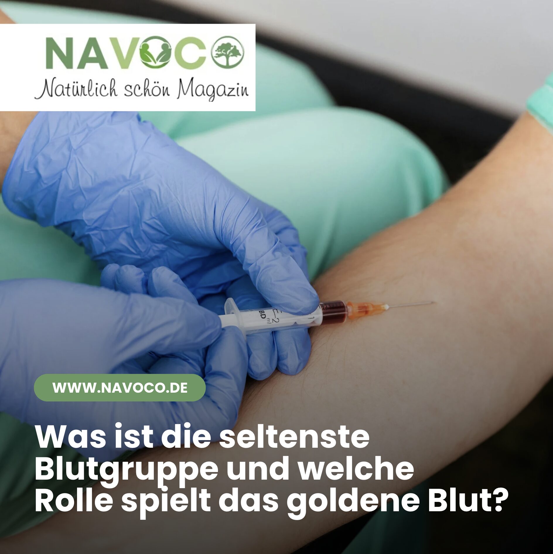 Was ist die seltenste Blutgruppe und welche Rolle spielt das goldene Blut? Was ist die seltenste Blutgruppe und welche Rolle spielt das goldene Blut?